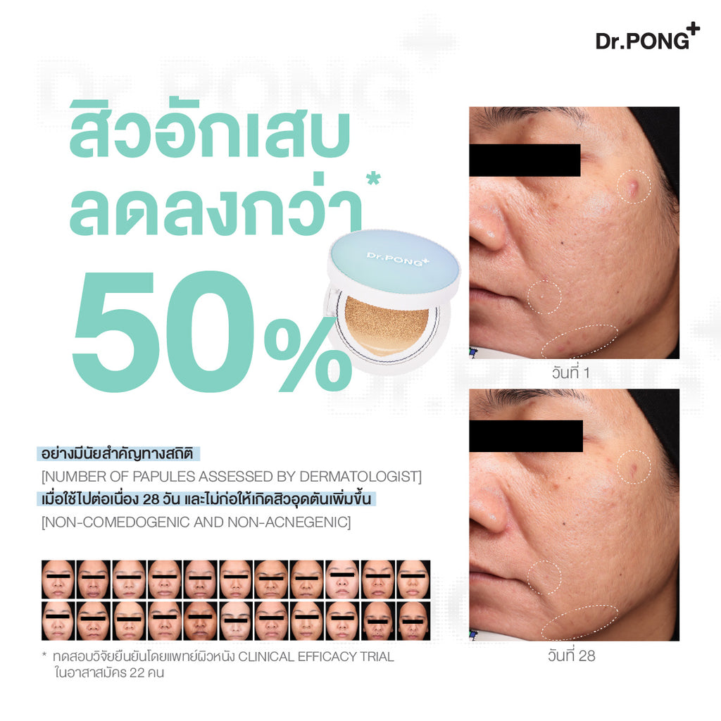 Dr.PONG_ACNE ACE LONGWEAR CUSHION_No.02_15g